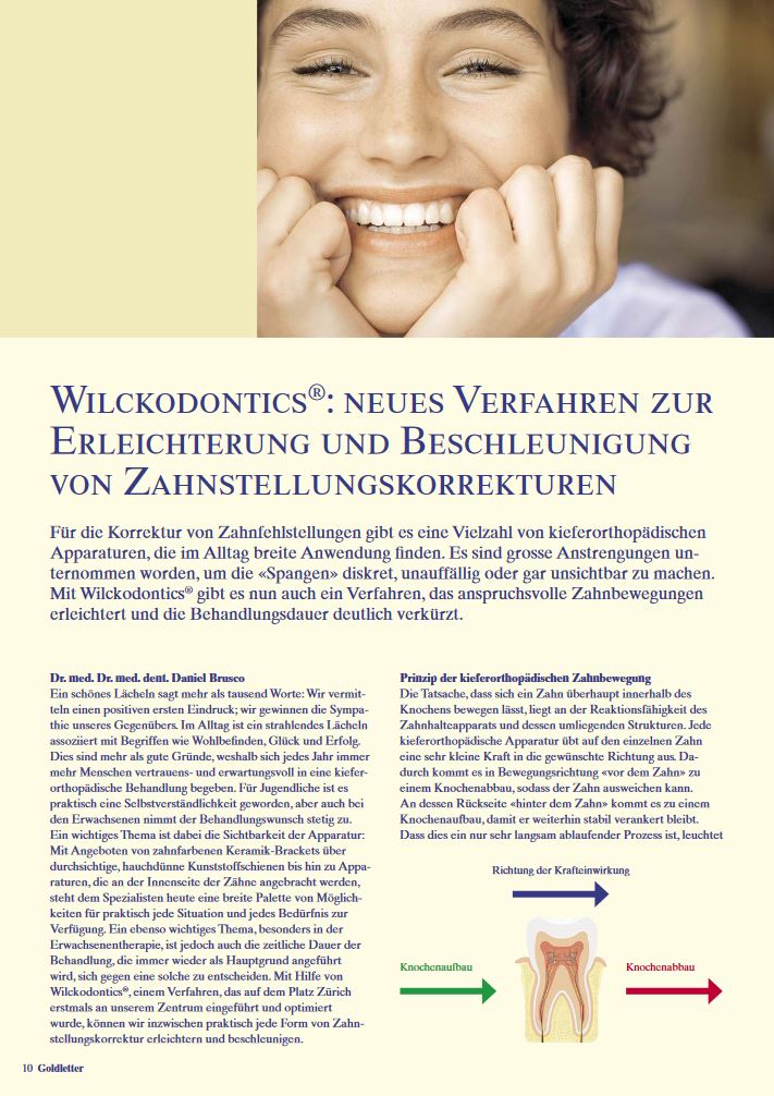 Wilckodontics: Neues Verfahren zur Erleichterung und Beschleunigung von Zahnstellungskorrekturen